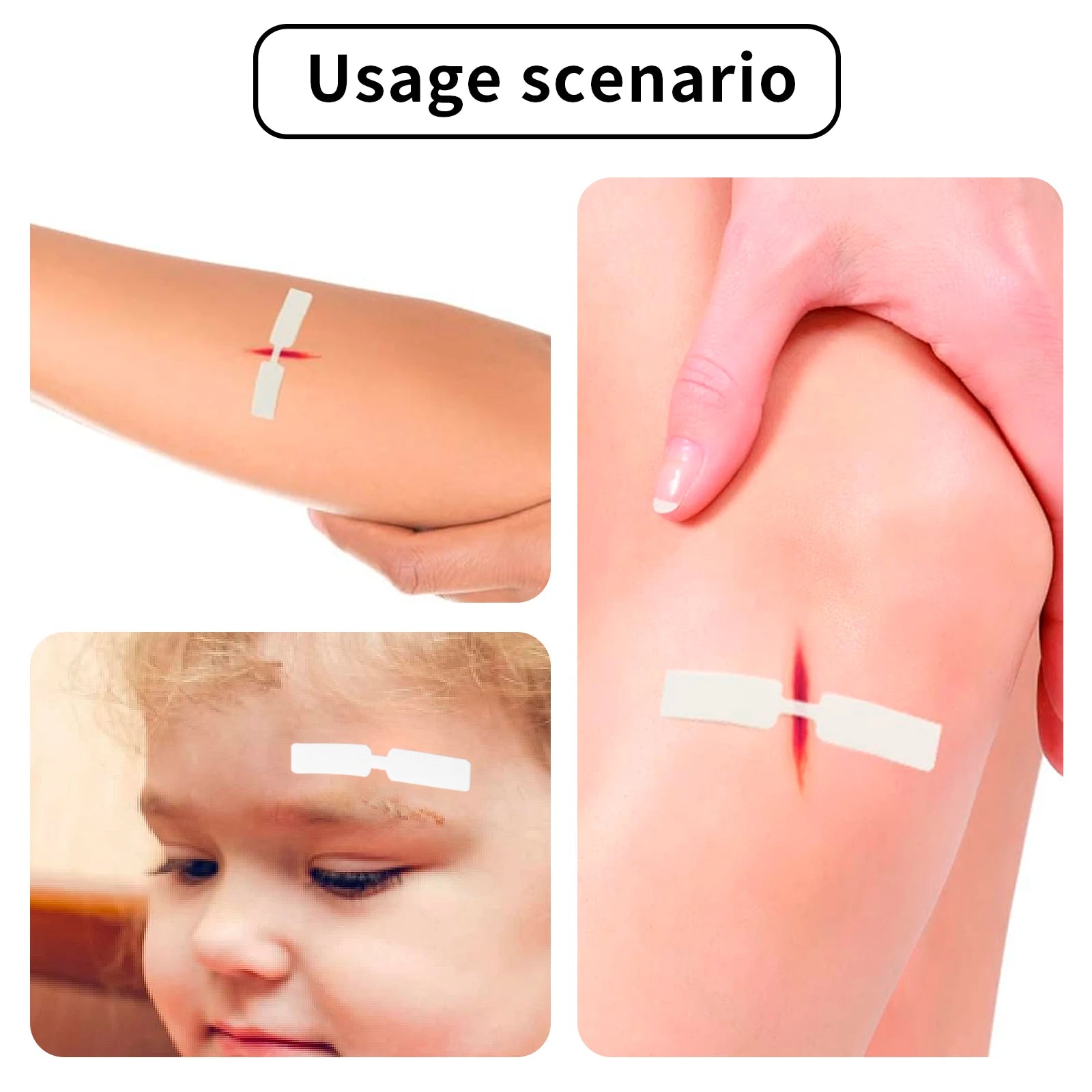 120PCS Waterproof Butterfly Band Aid – Small Adhesive Wound Closure Strips for Emergency Kits